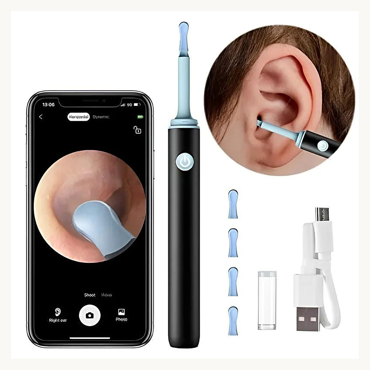 Ear cleaner with live camera view on phone and tips