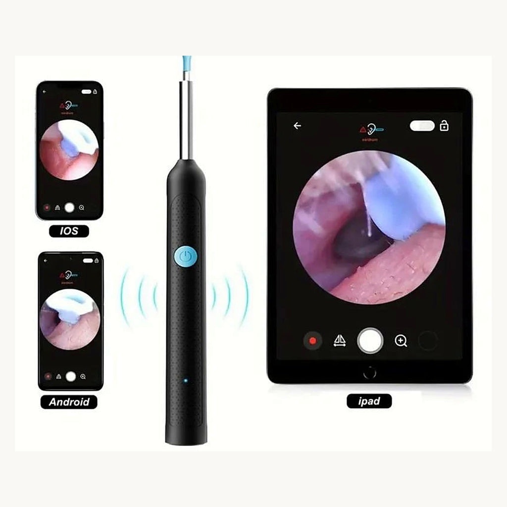 Ear cleaner live view on phone and tablet